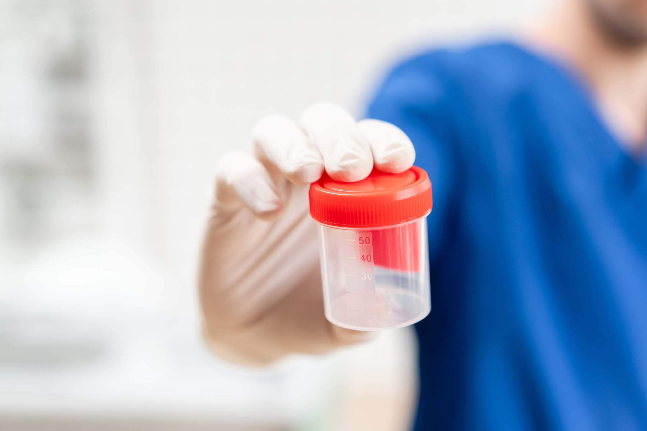 Safework Health provides urine drug testing in the workplace;