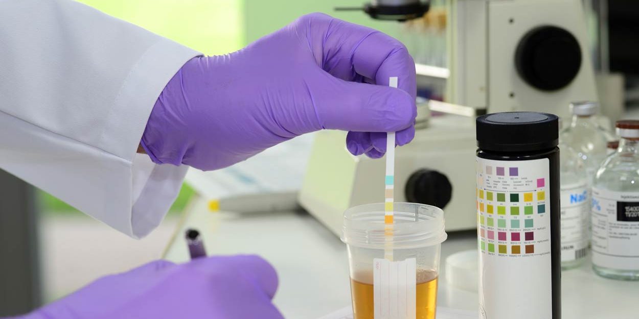 Does Synthetic Urine Help an Employee Evade Drug Detection?