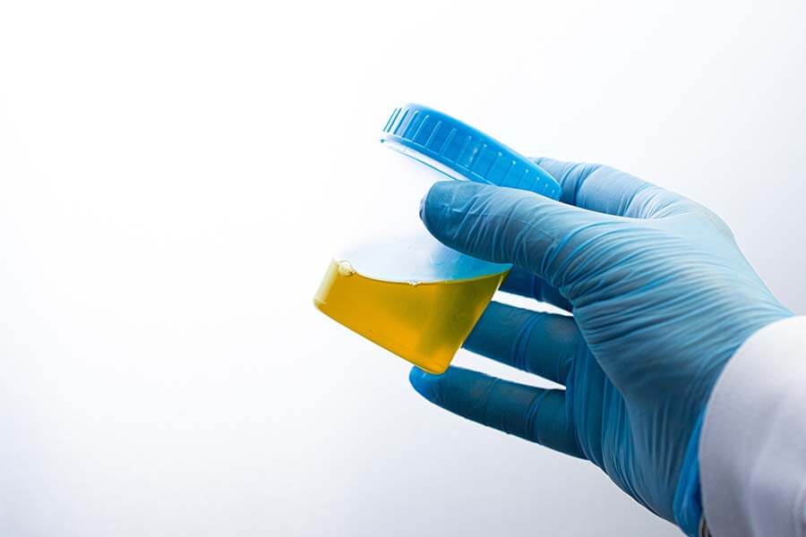 A urine drug test is a quick and accurate way of testing for drugs in a person’s system.;
